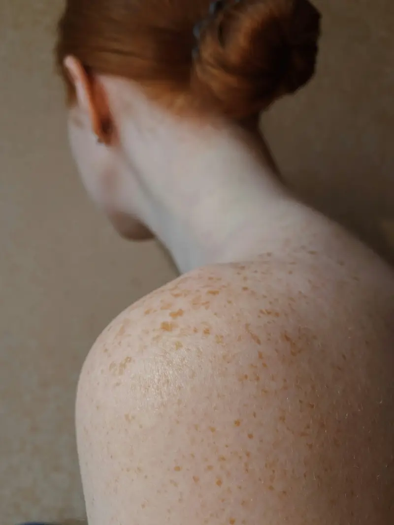 Nacken und Schulter mit Sommersprossen im warmen Licht, das Haar hochgesteckt